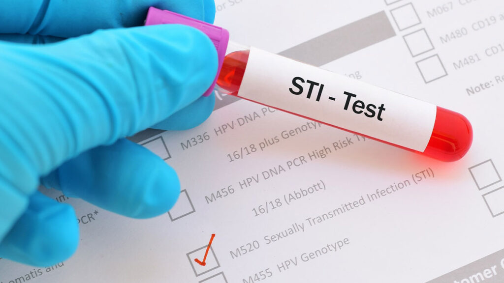 सेक्शुअली एक्टिव हैं? इन STI टेस्ट्स को करवाना न भूलें, लापरवाही पड़ सकती है भारी